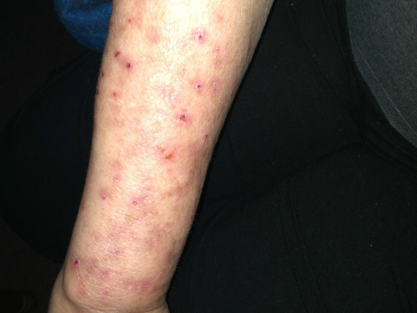 Top Rated Bed Bugs Control Madera