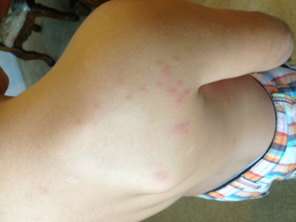 Best Bed Bugs Control services Madera